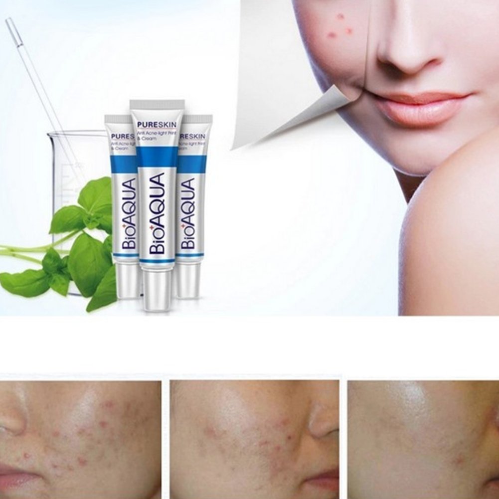 Crema Facial Antiacné Profesional