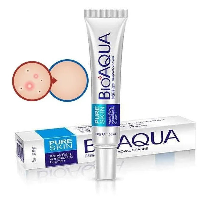 Crema Facial Antiacné Profesional