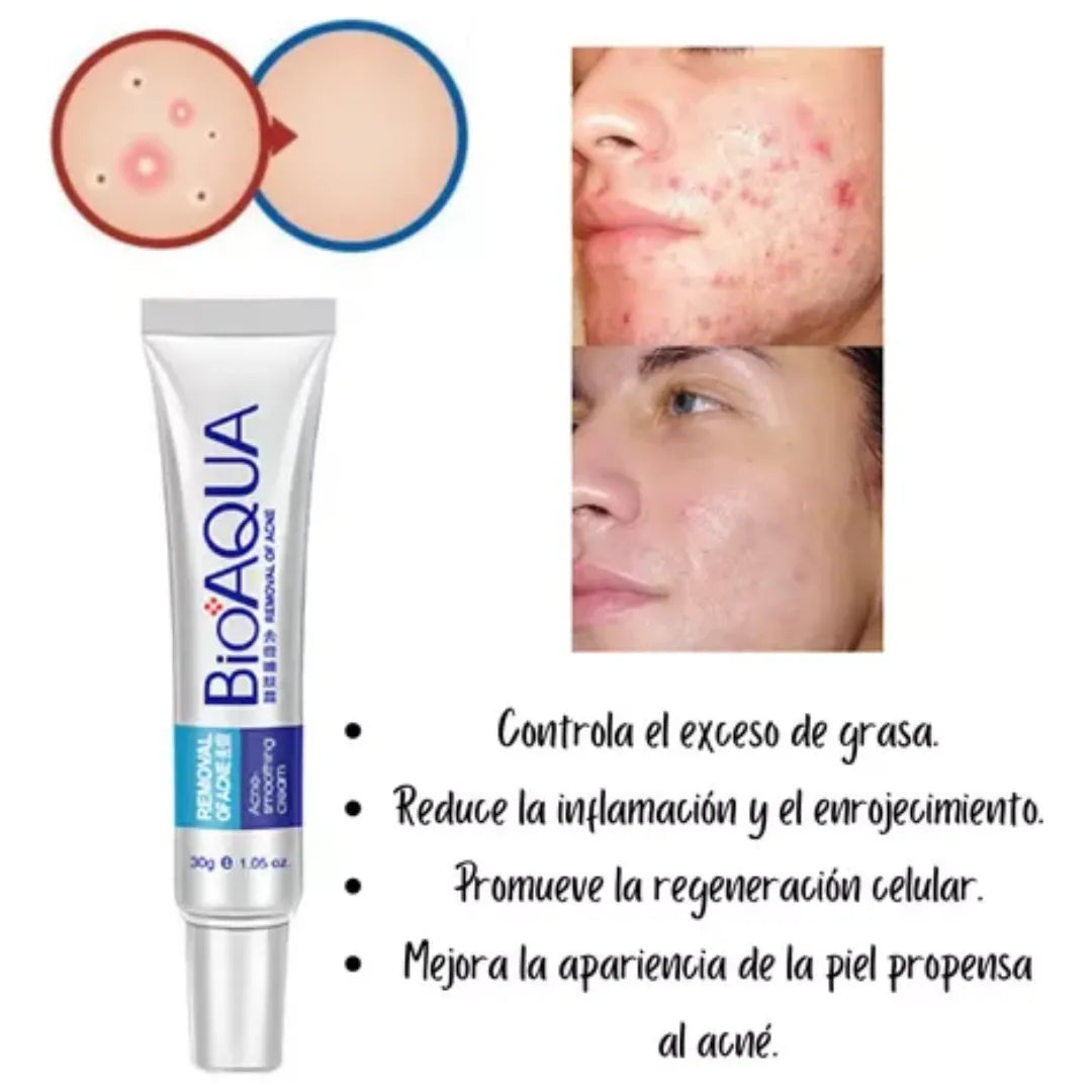 Crema Facial Antiacné Profesional
